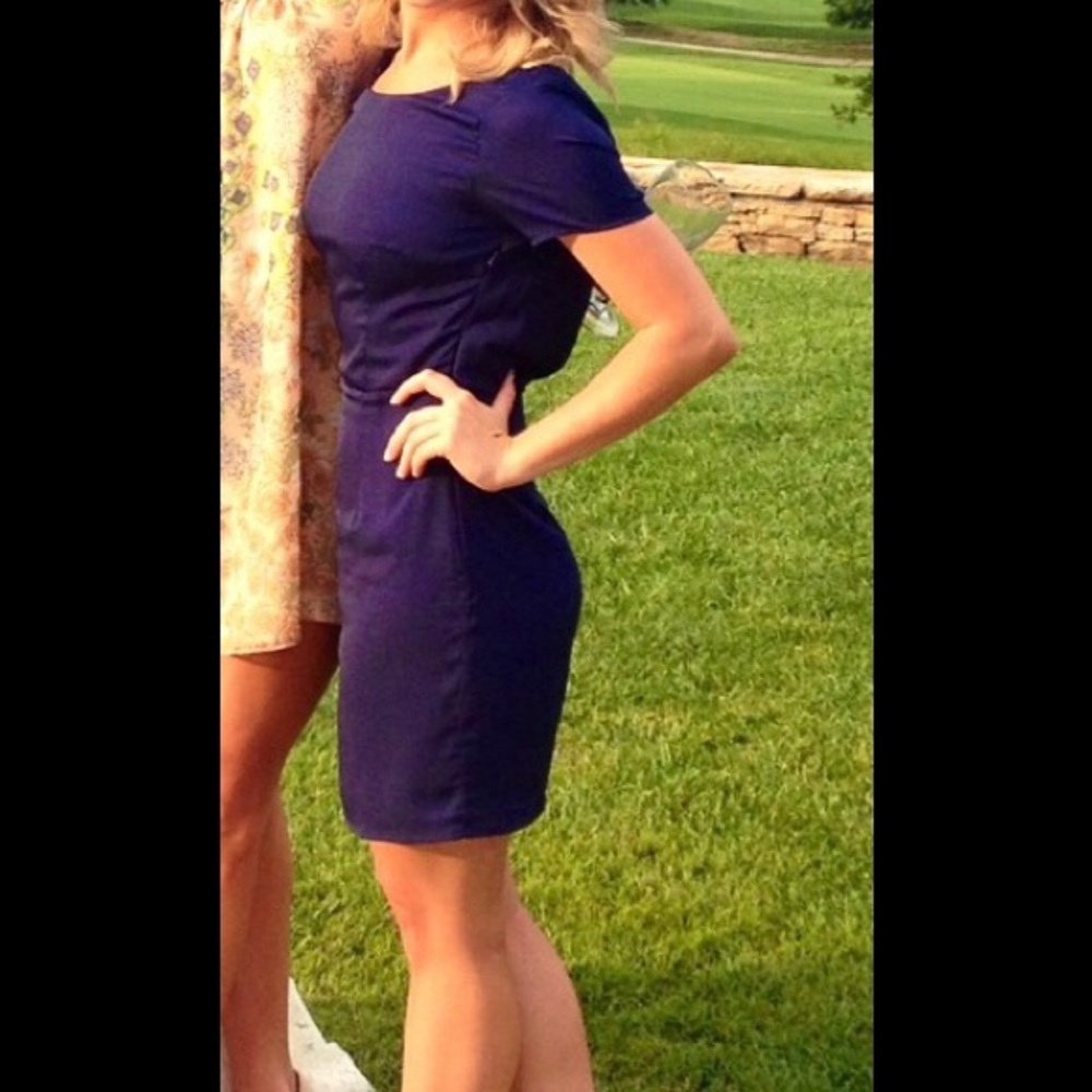 TOBI Blue Mini Dress
